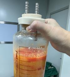 仙桃水动力吸脂手术要做多久？